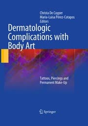 Tapa de Dermatologic complications with body art