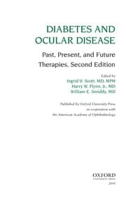 Tapa de Diabetes and ocular disease
