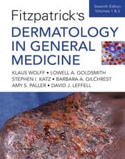 Tapa de Fitzpatrick's dermatology in general medicine