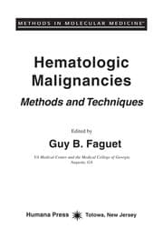 Tapa de Hematologic malignancies