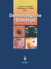 Tapa de Dermatologische Onkologie (German Edition)