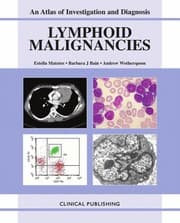 Tapa de Lymphoid malignancies