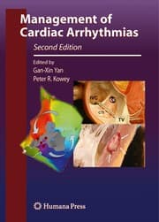 Tapa de Management of cardiac arrhythmias