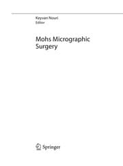 Tapa de Mohs Micrographic Surgery