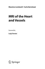 Tapa de MRI of the heart and vessels