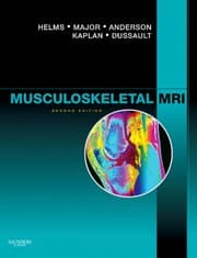 Tapa de Musculoskeletal MRI
