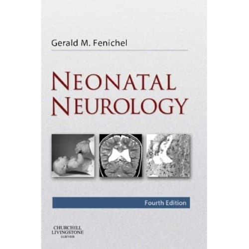 Tapa de Neonatal neurology