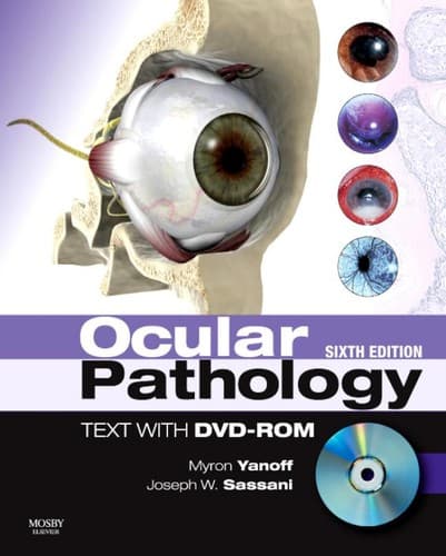 Tapa de Ocular pathology