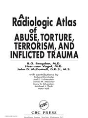 Tapa de A radiologic atlas of abuse, torture, terrorism, and inflicted trauma