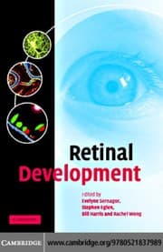 Tapa de Retinal development