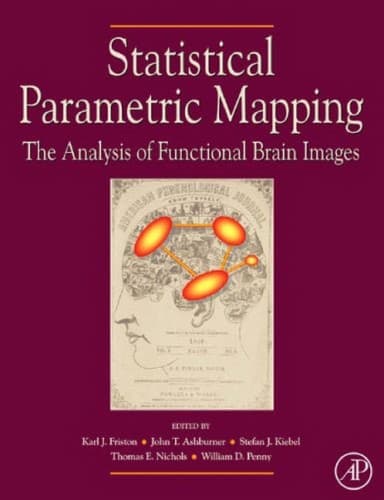 Tapa de Statistical parametric mapping