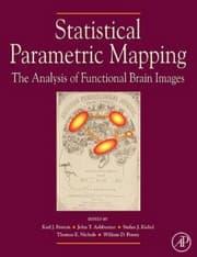 Tapa de Statistical parametric mapping