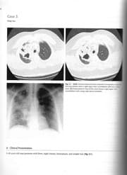 Tapa de Top 3 differentials in radiology