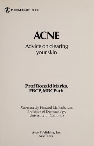 Tapa de Acne