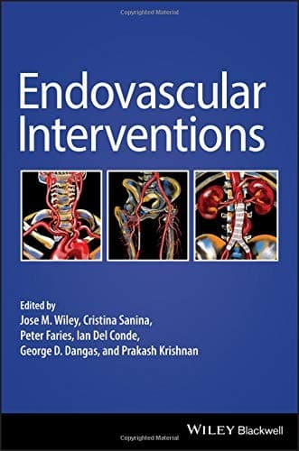 Tapa de Endovascular Interventions
