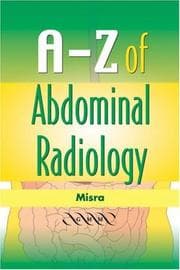 Tapa de A-Z of Abdominal Radiology