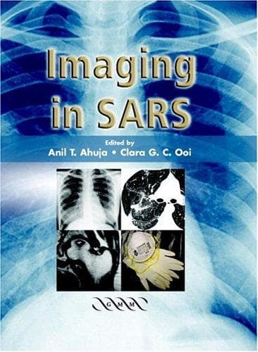 Tapa de Imaging in SARS
