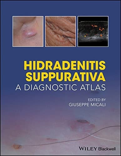 Tapa de Hidradenitis Suppurativa