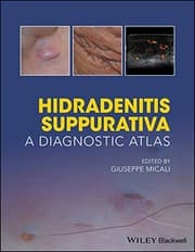 Tapa de Hidradenitis Suppurativa