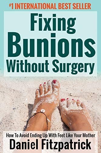 Tapa de Fixing Bunions Without Surgery