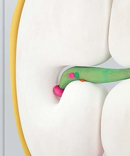 Tapa de Matthew Ronay