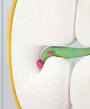 Tapa de Matthew Ronay