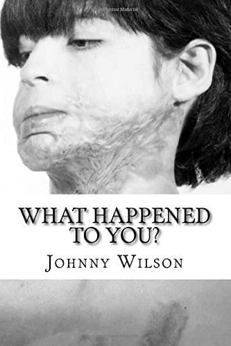 Tapa de What Happened to you?