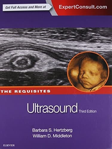 Tapa de Ultrasound