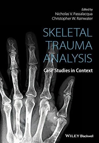 Tapa de Skeletal Trauma Analysis