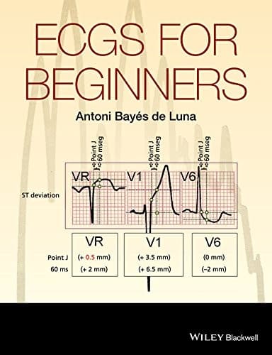 Tapa de ECGs for Beginners