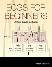 Tapa de ECGs for Beginners