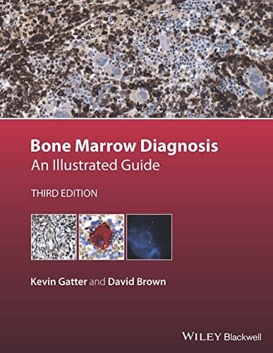 Tapa de Bone Marrow Diagnosis