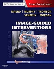 Tapa de Image-Guided Interventions