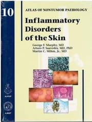 Tapa de Inflammatory Disorders of the Skin