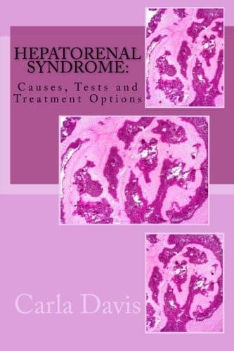 Tapa de Hepatorenal Syndrome