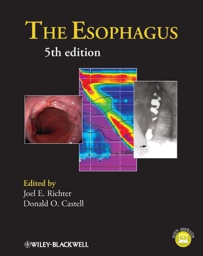 Tapa de The Esophagus