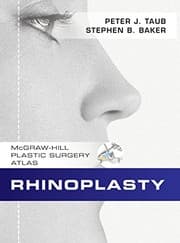 Tapa de Rhinoplasty