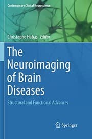 Tapa de The Neuroimaging of Brain Diseases