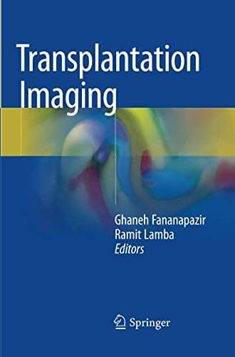Tapa de Transplantation Imaging