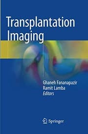 Tapa de Transplantation Imaging