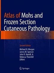 Tapa de Atlas of Mohs and Frozen Section Cutaneous Pathology