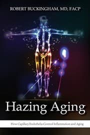 Tapa de Hazing Aging