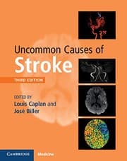 Tapa de Uncommon Causes of Stroke