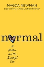 Tapa de Normal