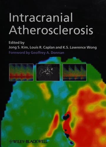 Tapa de Intracranial atherosclerosis