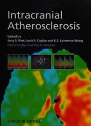 Tapa de Intracranial atherosclerosis