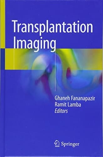 Tapa de Transplantation Imaging