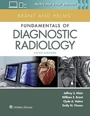 Tapa de Brant and Helms' Fundamentals of Diagnostic Radiology