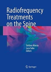 Tapa de Radiofrequency Treatments on the Spine