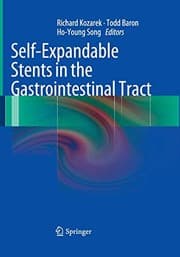 Tapa de Self-Expandable Stents in the Gastrointestinal Tract